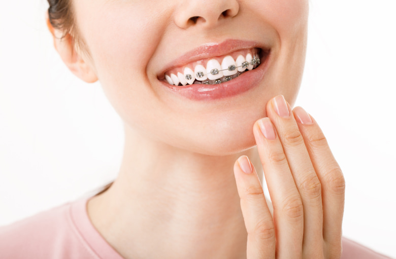 A photo of a girl wearing braces while happily smiling