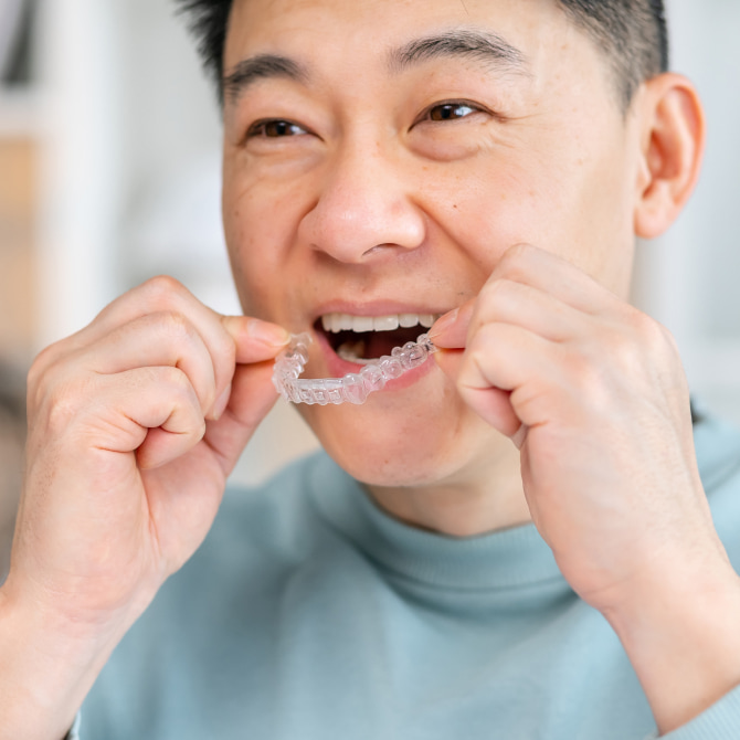 An adult man try put Invisalign on his teeth