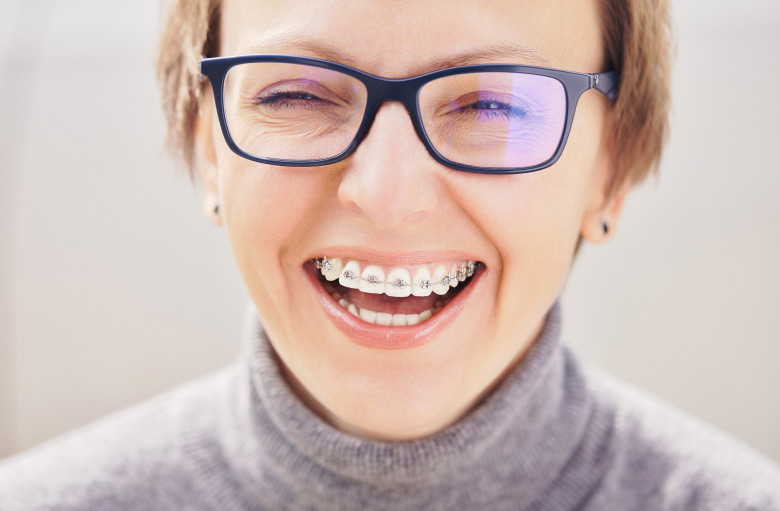 The woman in the glasses happily smiles while wear braces on her teeth