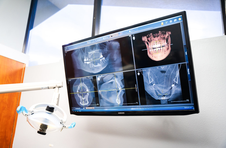 A photo of a laser dentistry