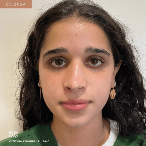 Photo after procedure 