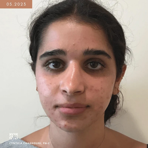 Photo before procedure