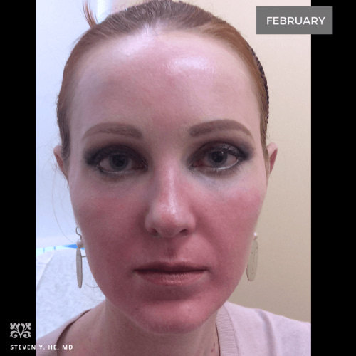 Photo our patient before procedure