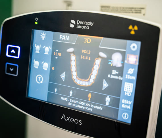 Photo of Axeos technique