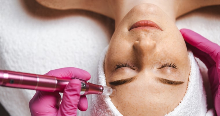 A patient relaxes during the micro-needling