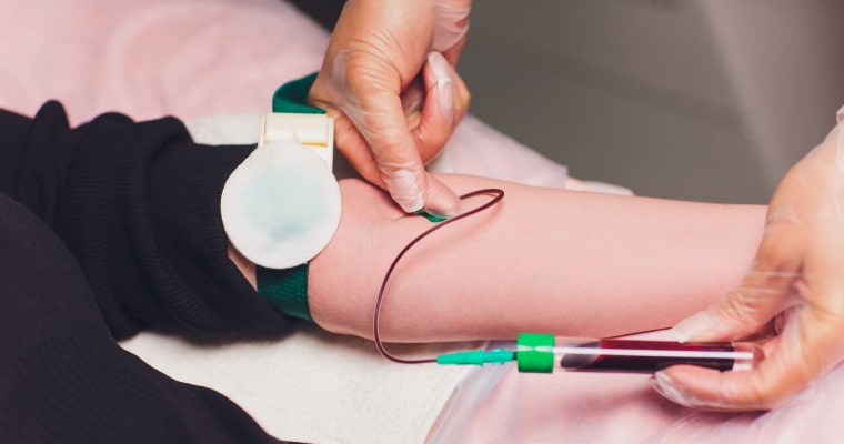 Collecting blood for the natural process of facial rejuvenation