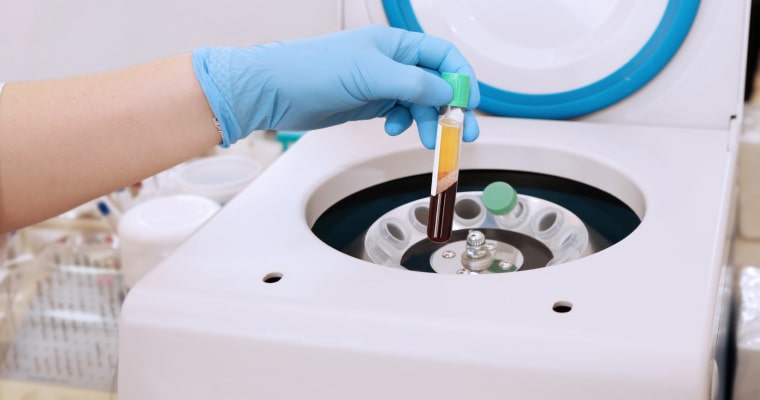 Processing the collected blood for the treatment