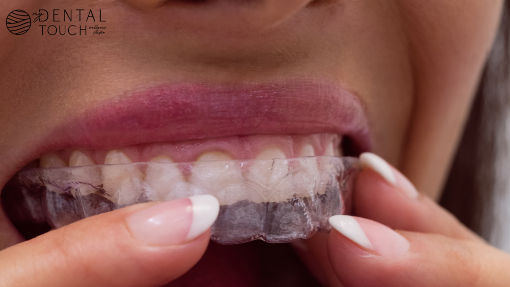 Invisalign