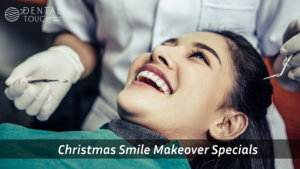 Smile makeover