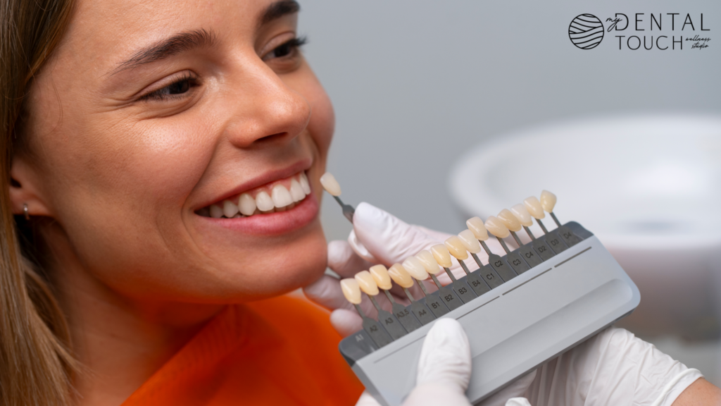 Dental Bonding